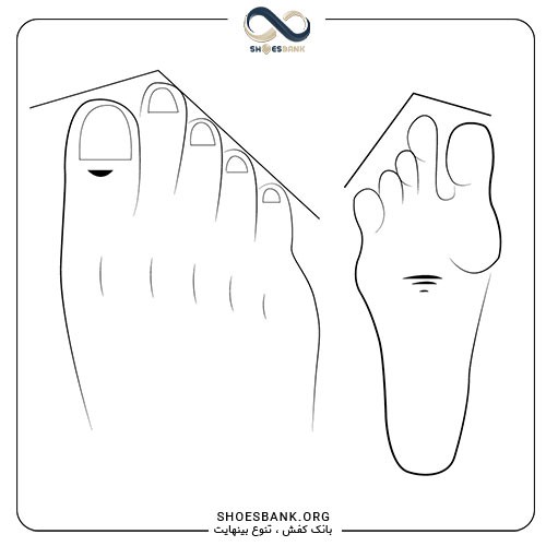 مدل پای یونانی